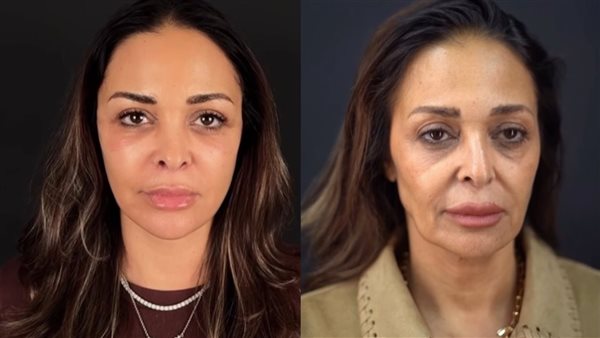داليا البحيري تجري عملية تجميل لشد الوجه والرقبة: حاسة إني لسه صغيرة - الوان اف ام